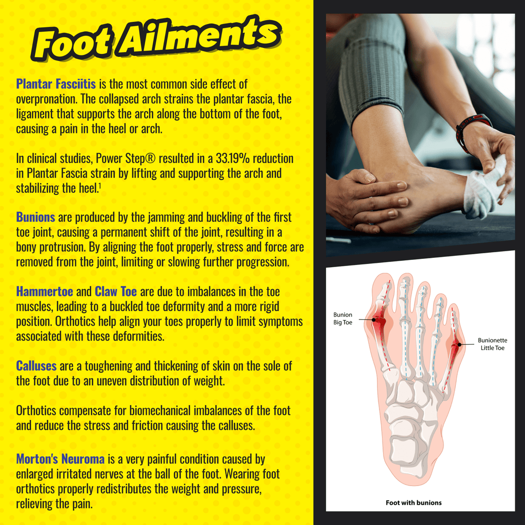 Powerstep ProTech Full Length Insoles for Arch Support and Pain Relief